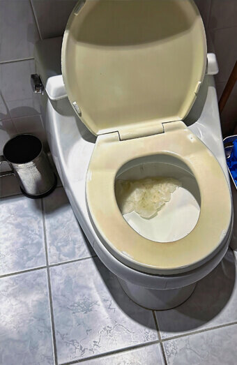 https://blockeddrainsyokine.com.au/uploads/2025/07/blocked-toilet-27293.jpg