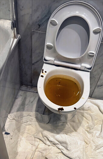 https://blockeddrainsyokine.com.au/uploads/2025/07/blocked-toilet-27793.jpg
